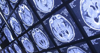 фото: on-medic.com