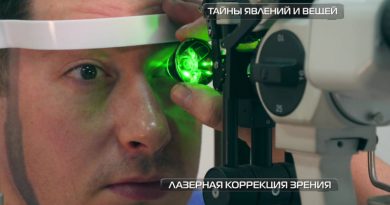 Лазерная коррекция | Фото: chudo.tech
