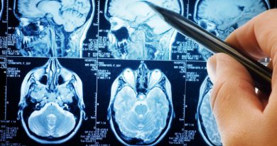 Исследование головного мозга | Фото: likarni.com