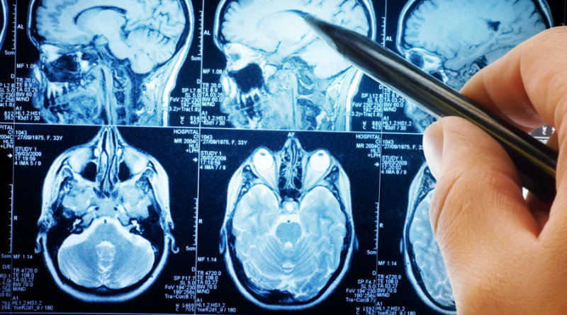 Исследование головного мозга | Фото: likarni.com