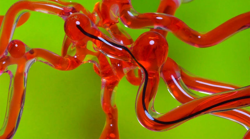 робот-«червь» для борьбы с инсультами