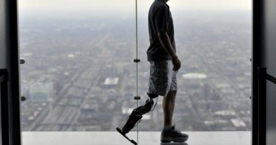 Протез | Фото: https://www.sralab.org