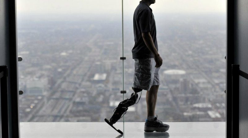 Протез | Фото: https://www.sralab.org