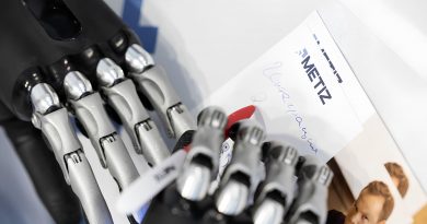 bionicheskie-protezy-kistej-s-oblachnym-po