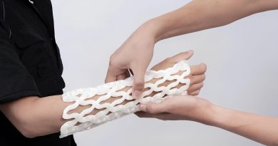 gips-tessacast