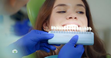 gollivudskaya-ulybka-svoimi-rukami