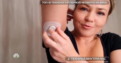 chipirovanie-vsyo-blizhe